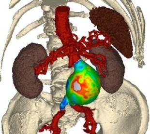 Biomedical Fluid Dynamics